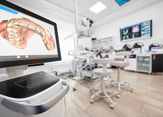 Dental scan displayed on monitor in treatment room