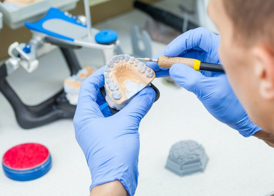 Technician adjusting the plaster model of a denture
