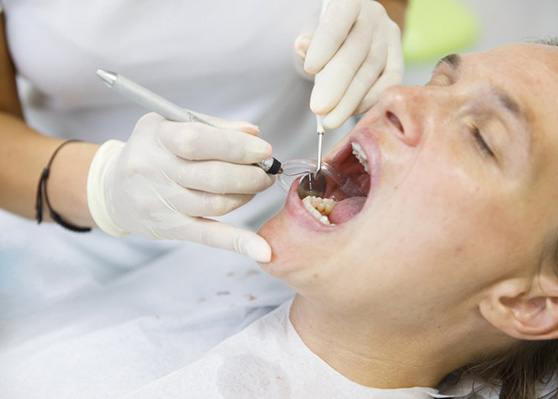 Patient having their teeth cleaned 