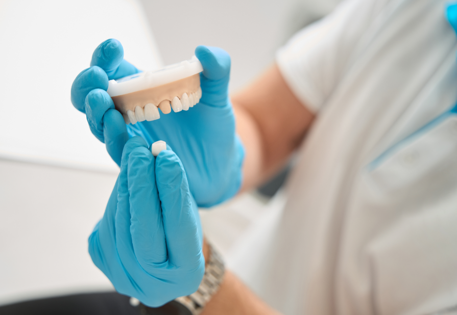 Dentist holding model dental crown